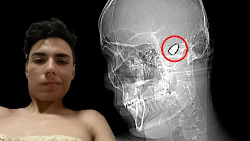 Kafasında Patlamaya Hazır Bomba Taşıyan Kadın: Test sonuçları Neler Söylüyor?
