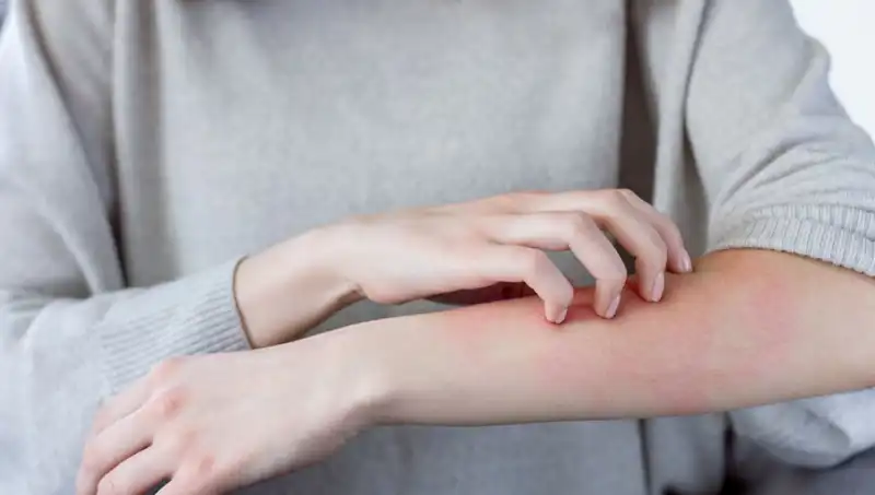 Cilt Kanserinin Gizli Belirtilerini Keşfedin: Dermatologdan Önemli Uyarılar